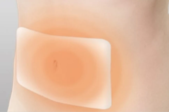 アイセラピスト使用イメージ